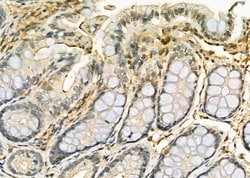 Invitrogen DYNLT3 Polyclonal Antibody 100 &mu;L | Buy Online | Invitrogen&trade; | Fisher Scientific