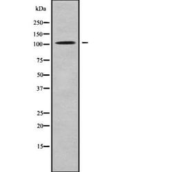 Invitrogen HACE1 Polyclonal Antibody 100 &mu;L; Unconjugated:Antibodies,