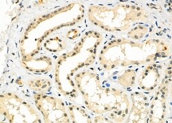 Invitrogen HECTD1 Polyclonal Antibody 100 &mu;L; Unconjugated:Antibodies,