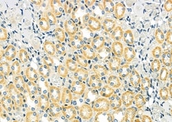 Invitrogen LRSAM1 Polyclonal Antibody 100 &mu;L; Unconjugated:Antibodies,