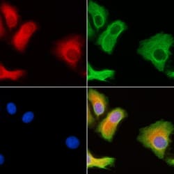 Invitrogen TEB4 Polyclonal Antibody 100 &mu;L; Unconjugated:Antibodies,