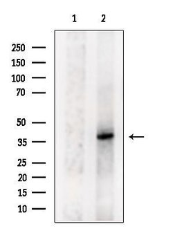 Invitrogen MARCH9 Polyclonal Antibody 100 &mu;L; Unconjugated:Antibodies,