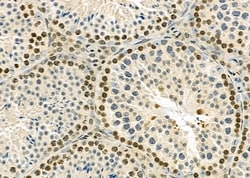 Invitrogen RNF41 Polyclonal Antibody 100 &mu;L; Unconjugated:Antibodies,