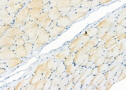 Invitrogen ZNRF1 Polyclonal Antibody 100 &mu;L; Unconjugated:Antibodies,