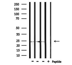 Invitrogen ZNRF1 Polyclonal Antibody 100 &mu;L; Unconjugated:Antibodies,