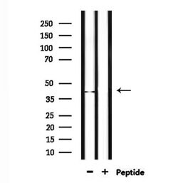 Invitrogen NEIL2 Polyclonal Antibody 100 &mu;L; Unconjugated:Antibodies,