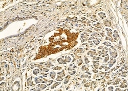 Invitrogen EDEM2 Polyclonal Antibody 100 &mu;L; Unconjugated:Antibodies,