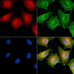 Invitrogen HSD17B12 Polyclonal Antibody 100 &mu;L; Unconjugated:Antibodies,