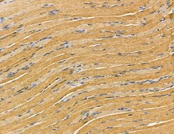 Invitrogen HSD17B12 Polyclonal Antibody 100 &mu;L; Unconjugated:Antibodies,