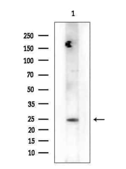 Invitrogen HSD17B12 Polyclonal Antibody 100 &mu;L; Unconjugated:Antibodies,