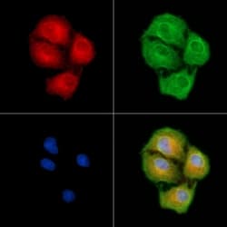Invitrogen HSD17B8 Polyclonal Antibody 100 &mu;L; Unconjugated:Antibodies,