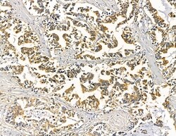 Invitrogen HSD17B8 Polyclonal Antibody 100 &mu;L; Unconjugated:Antibodies,