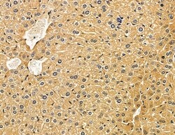 Invitrogen HSD17B8 Polyclonal Antibody 100 &mu;L; Unconjugated:Antibodies,