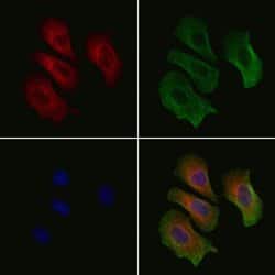 Invitrogen ETAA1 Polyclonal Antibody 100 &mu;L; Unconjugated:Antibodies,
