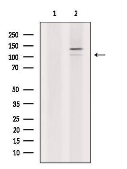 Invitrogen ETAA1 Polyclonal Antibody 100 &mu;L; Unconjugated:Antibodies,