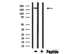 Invitrogen FANCM Polyclonal Antibody 100 &mu;L; Unconjugated:Antibodies,