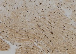 Invitrogen KHSRP Polyclonal Antibody 100 &mu;L; Unconjugated:Antibodies,