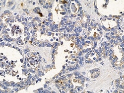 Invitrogen FOLR3 Polyclonal Antibody 100 &mu;L; Unconjugated:Antibodies,