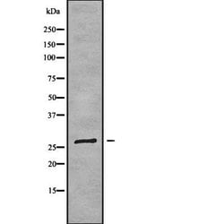 Invitrogen FOLR3 Polyclonal Antibody 100 &mu;L; Unconjugated:Antibodies,