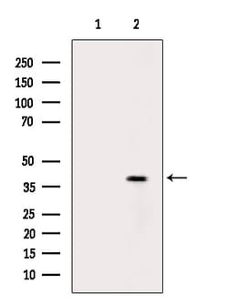 FUT2 Polyclonal Antibody:Antibodies, Polyclonal