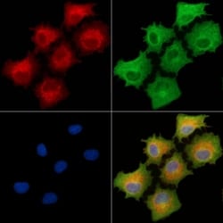 Invitrogen GABRR1 Polyclonal Antibody 100 &mu;L; Unconjugated:Antibodies,