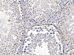 Invitrogen GCP2 Polyclonal Antibody 100 &mu;L; Unconjugated:Antibodies,