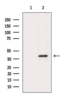 Invitrogen GMDS Polyclonal Antibody 100 &mu;L | Buy Online | Invitrogen&trade; | Fisher Scientific