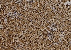 Invitrogen QSER1 Polyclonal Antibody 100 &mu;L; Unconjugated:Antibodies,