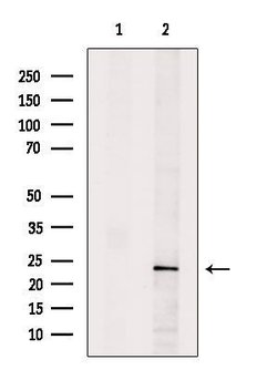 Invitrogen HPGDS Polyclonal Antibody 100 &mu;L; Unconjugated:Antibodies,