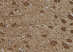 Invitrogen GON4L Polyclonal Antibody 100 &mu;L; Unconjugated:Antibodies,
