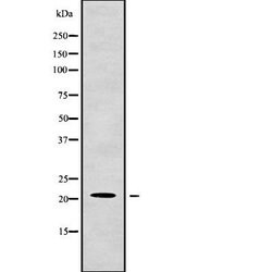 Invitrogen G-CSF Polyclonal Antibody 100 &mu;L; Unconjugated:Antibodies,