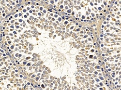 Invitrogen GCH1 Polyclonal Antibody 100 &mu;L; Unconjugated:Antibodies,