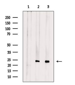 Invitrogen GCH1 Polyclonal Antibody 100 &mu;L; Unconjugated:Antibodies,