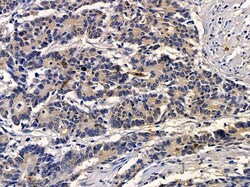 TRIM23 Polyclonal Antibody:Antibodies, Polyclonal