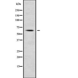 TRIM23 Polyclonal Antibody:Antibodies, Polyclonal