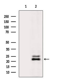 Invitrogen DIRAS2 Polyclonal Antibody 100 &mu;L | Buy Online | Invitrogen&trade; | Fisher Scientific
