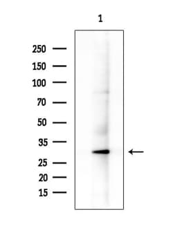 Invitrogen REM2 Polyclonal Antibody 100 &mu;L; Unconjugated:Antibodies,