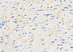 Invitrogen SAR1A Polyclonal Antibody 100 &mu;L; Unconjugated:Antibodies,