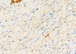 Invitrogen SAR1A Polyclonal Antibody 100 &mu;L; Unconjugated:Antibodies,