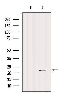 Invitrogen SAR1A Polyclonal Antibody 100 &mu;L; Unconjugated:Antibodies,