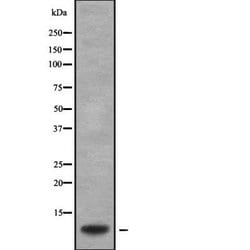 Invitrogen GNG2 Polyclonal Antibody 100 &mu;L | Buy Online | Invitrogen&trade; | Fisher Scientific