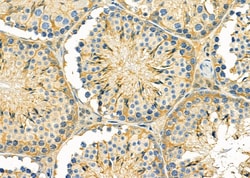 Invitrogen GNG8 Polyclonal Antibody 100 &mu;L; Unconjugated:Antibodies,