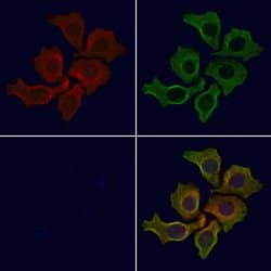Invitrogen GNB3 Polyclonal Antibody 100 &mu;L; Unconjugated:Antibodies,