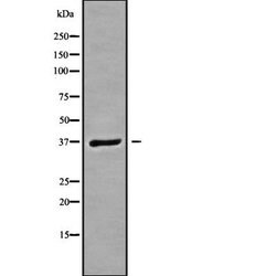 Invitrogen GNB3 Polyclonal Antibody 100 &mu;L; Unconjugated:Antibodies,