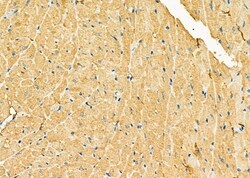 Invitrogen GUCA2B Polyclonal Antibody 100 &mu;L; Unconjugated:Antibodies,