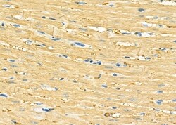 Invitrogen GUCA2B Polyclonal Antibody 100 &mu;L; Unconjugated:Antibodies,