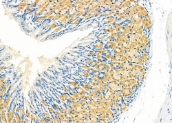 Invitrogen GUCA2B Polyclonal Antibody 100 &mu;L; Unconjugated:Antibodies,