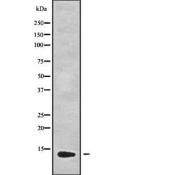 Invitrogen GUCA2B Polyclonal Antibody 100 &mu;L; Unconjugated:Antibodies,