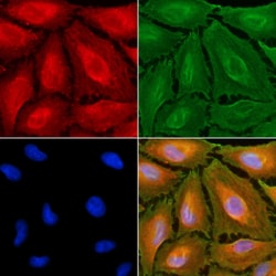 Invitrogen HLA-DMA Polyclonal Antibody 100 &mu;L; Unconjugated:Antibodies,