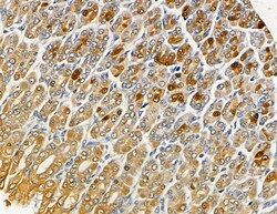 Invitrogen HLA-DMA Polyclonal Antibody 100 &mu;L; Unconjugated:Antibodies,